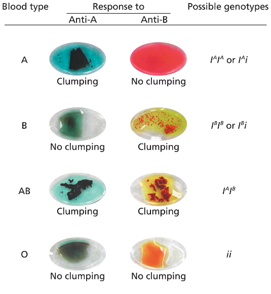 Table showing blood types A, B, AB, O with clumping reactions to Anti-A and Anti-B and possible genotypes.