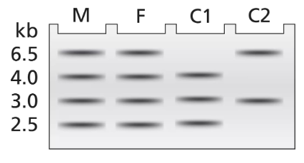 Gel electrophoresis results showing DNA band patterns for mother, father, and two children, with size markers indicated.