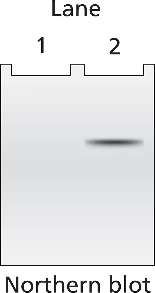 Northern blot showing mRNA bands for lanes 1 and 2 from E. coli grown in glucose and lactose media, respectively.