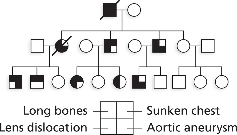 Pedigree chart illustrating Marfan syndrome symptoms: long bones, lens dislocation, sunken chest, and aortic aneurysm.