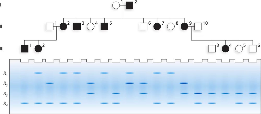 Pedigree chart of a three-generation family with RFLP gel results for genetic analysis of an autosomal recessive disease.