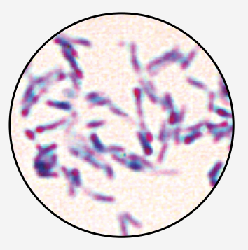 Microscopic view of rod-shaped, purple-stained bacteria clustered on a light background.