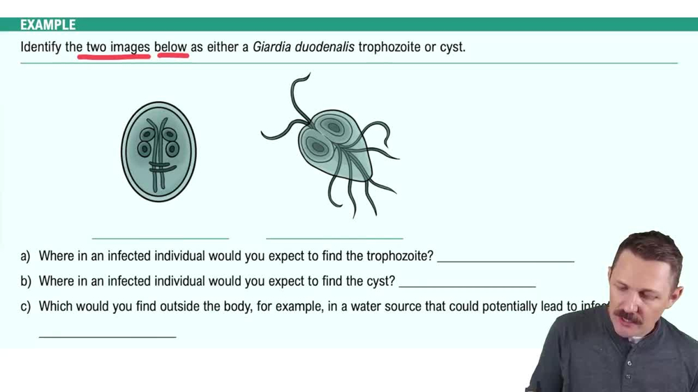 Protozoan Diseases of the Digestive System Example 1