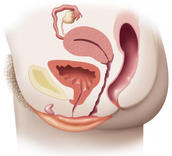 Side view illustration of female urinary and reproductive organs showing infection pathways of E. coli and N. gonorrhoeae.