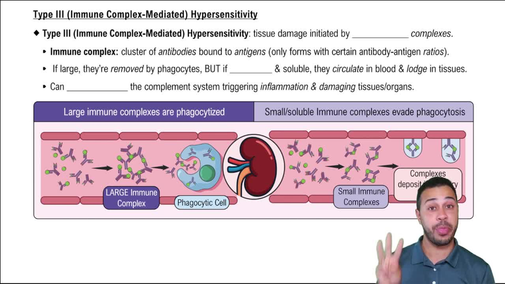 Type III (Immune Complex-Mediated) Hypersensitivity