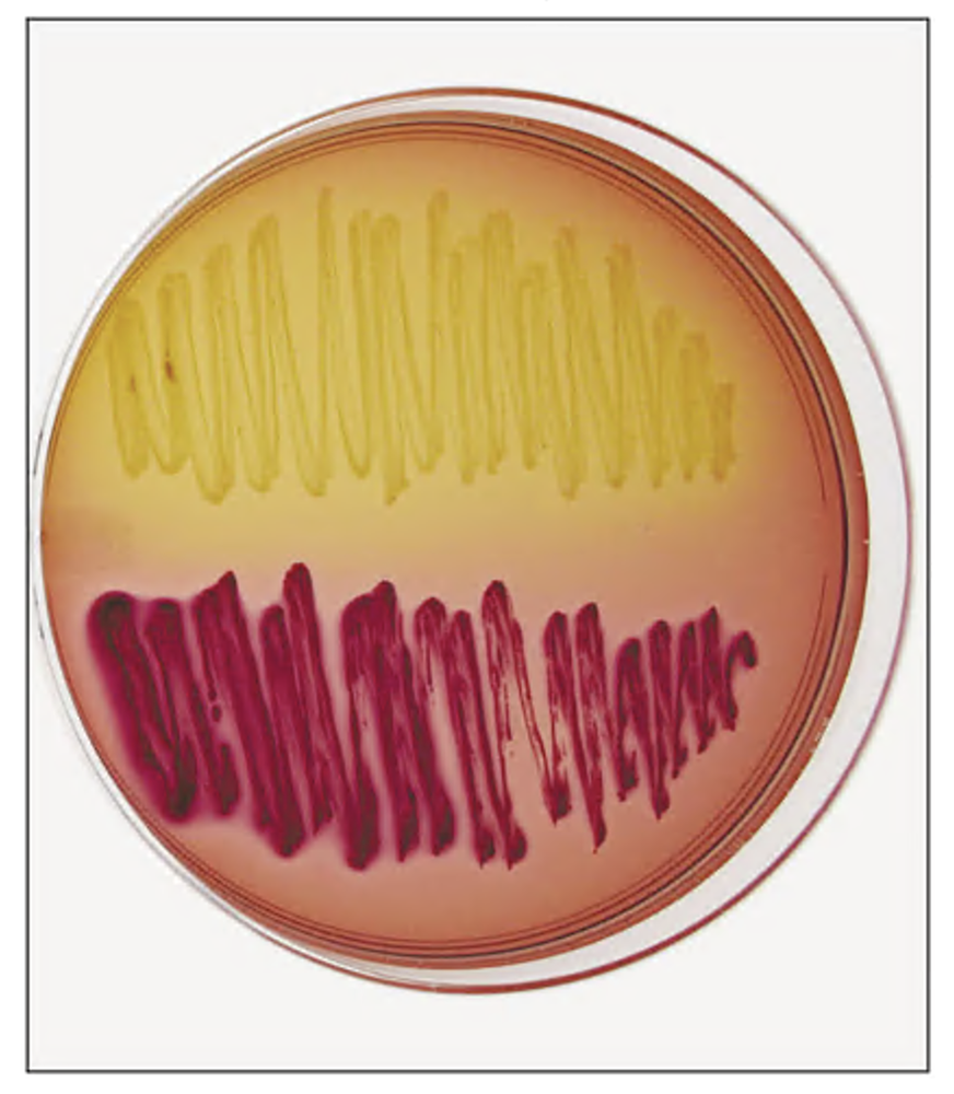 MacConkey agar plate showing two bacteria: one pale yellow (Gram-negative, non-lactose fermenter) and one pink-red (Gram-negative, lactose fermenter).