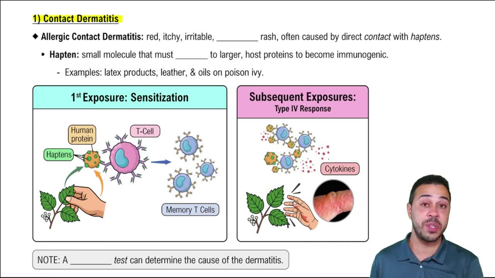 1) Contact Dermatitis