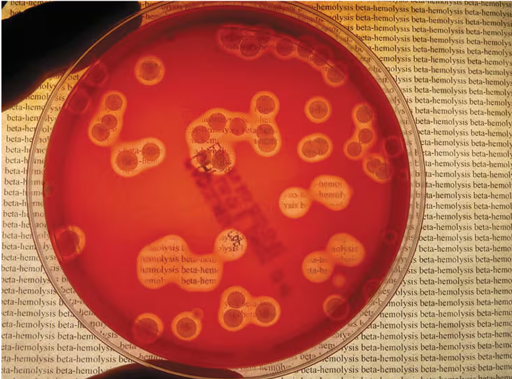 Petri dish showing clear zones around Staphylococcus aureus colonies indicating beta-hemolysis on blood agar.