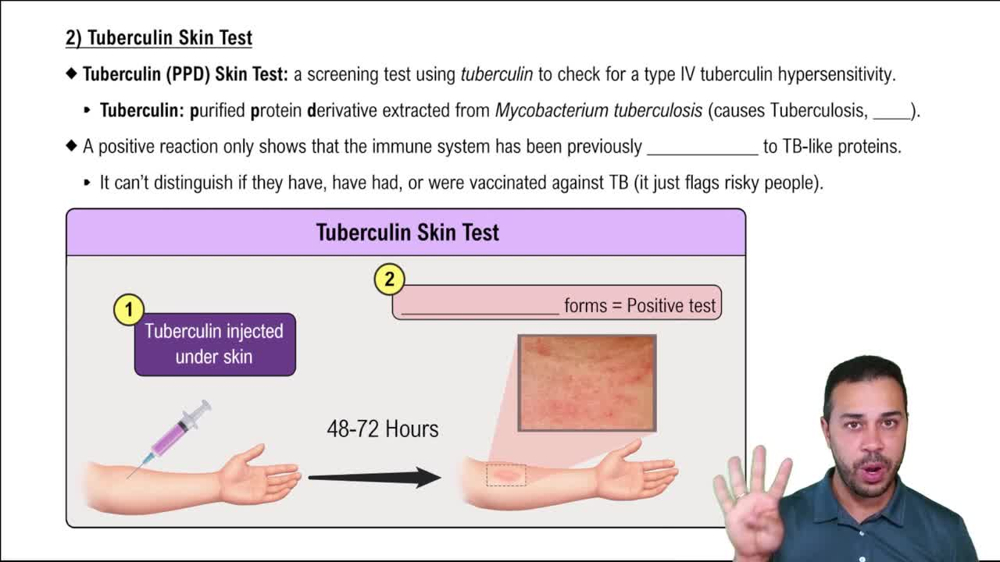 2) Tuberculin Skin Test