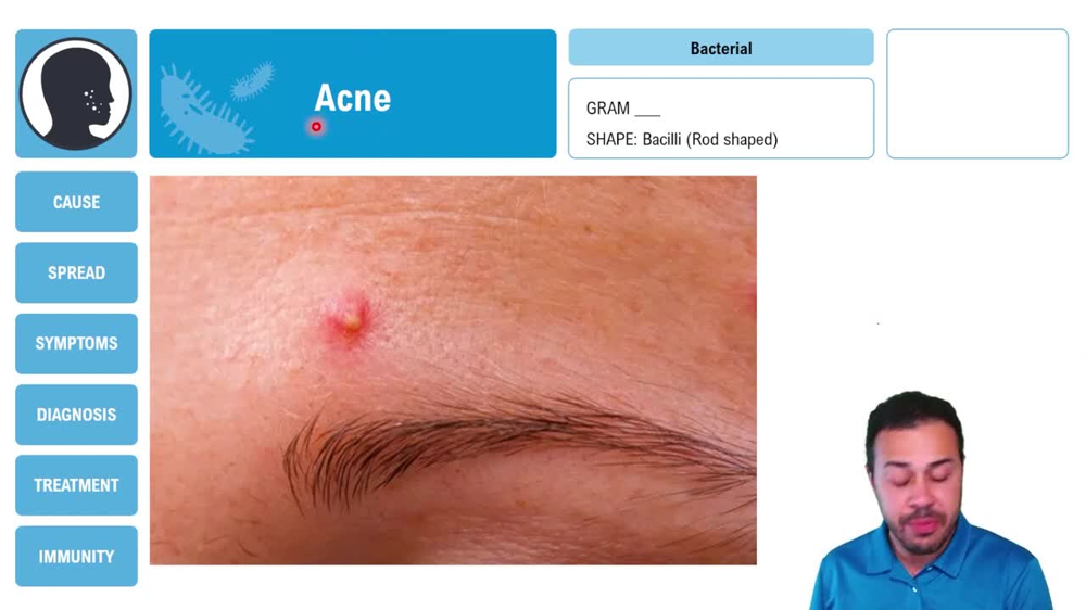 Acne