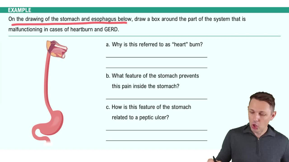 Disorders of the Digestive System Example 1
