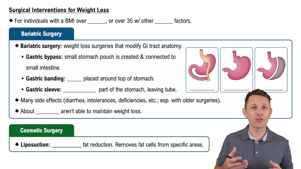 Surgical Interventions for Weight Loss