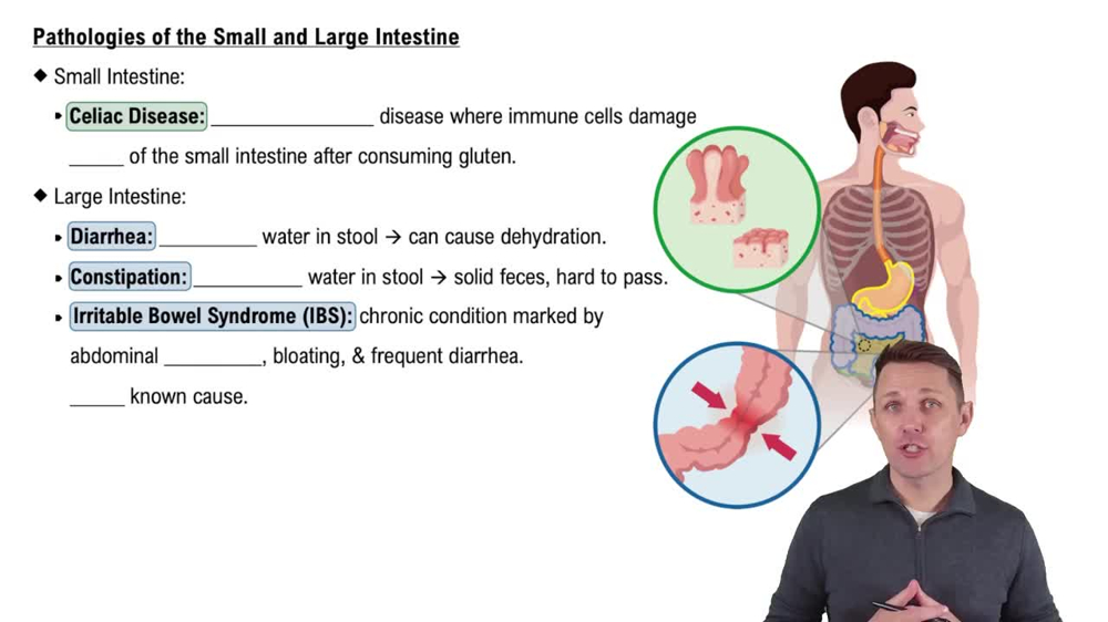Pathologies of the Small and Large Intestine