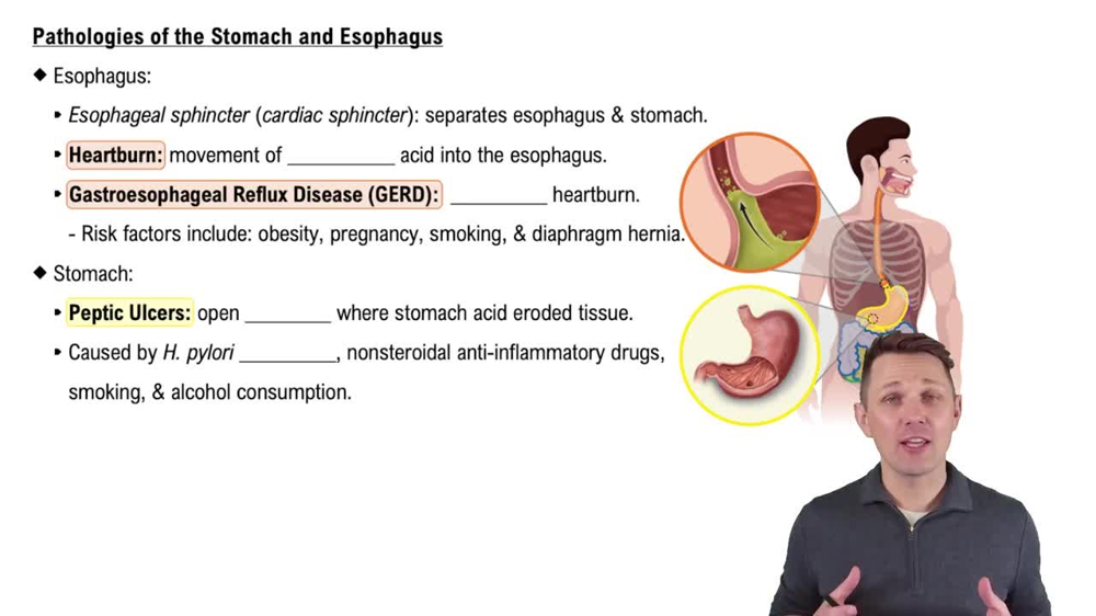 Pathologies of the Stomach and Esophagus