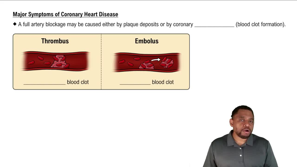 Major Symptoms of Coronary Heart Disease Concept 5