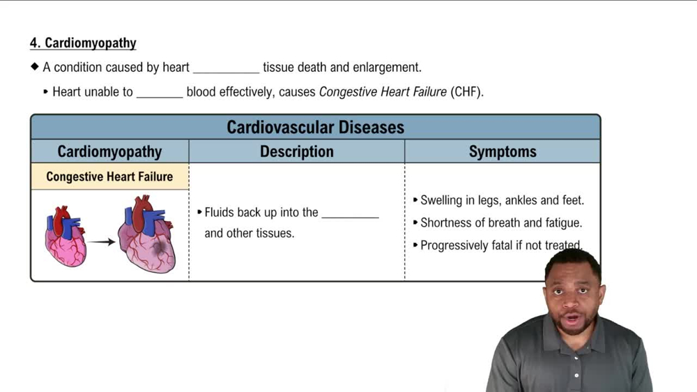 Cardiomyopathy Concept 8