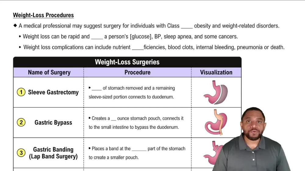 Weight-Loss Procedures Concept 2