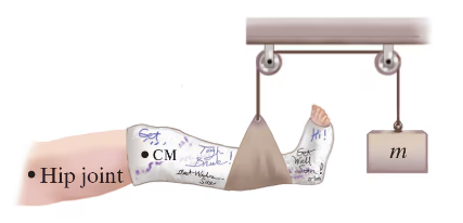 Illustration of a leg in a cast suspended by a pulley system, showing hip joint, center of mass, and mass m for equilibrium calculation.