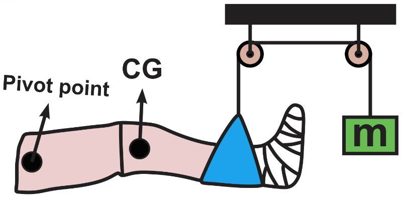 Diagram showing a limb in a cast with pivot point and center of gravity for torque calculation.