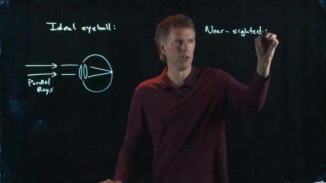 Anderson Video - Optical Instruments- Eyeballs