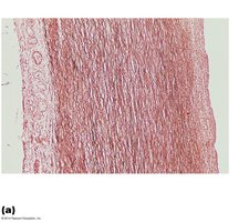 Elastic artery histology