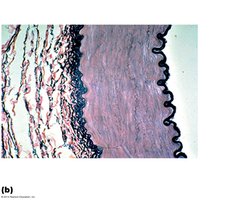 Muscular artery histology