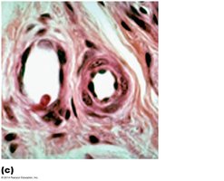 Small arteriole histology