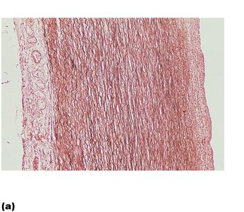 Histological section of an elastic artery
