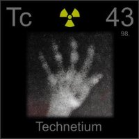 Technetium hand scan